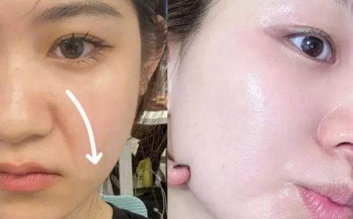 补水抗皱护肤品哪个牌子效果好？十大最有效抗衰老产品公布(图5)
