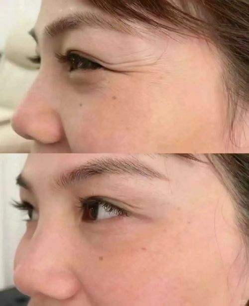 抗衰老的护肤品哪个牌子好？年度抗衰老产品排行榜前10强揭晓！(图5)