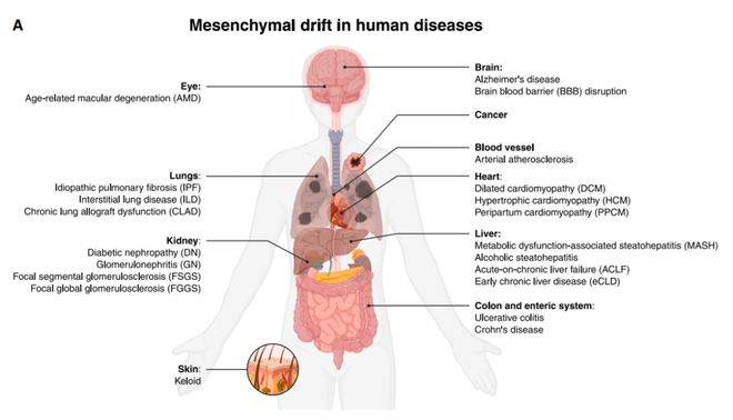 抗衰老公司Altos Labs最新Cell论文：发现衰老与疾病的共性——间充质漂移而逆转这一状态可返老还童(图2)