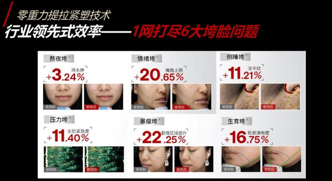 极萌胶原炮好用吗？航天级抗衰科技的真实体验报告(图3)