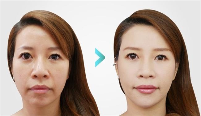 哪种胶原蛋白肽抗衰老效果最好？十大胶原蛋白肽品牌排行榜10强流失率改善测评(图18)