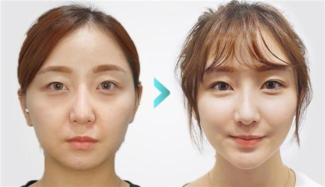 哪种胶原蛋白肽抗衰老效果最好？十大胶原蛋白肽品牌排行榜10强流失率改善测评(图20)