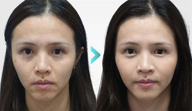 哪种胶原蛋白肽抗衰老效果最好？十大胶原蛋白肽品牌排行榜10强流失率改善测评(图19)