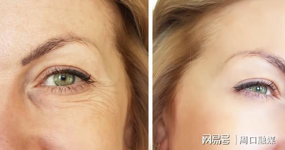 NMN抗衰老真相揭秘：科学实验数据告诉你值不值得选择(图1)