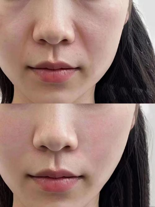 淡纹抗皱护肤推荐揭晓紧致抗老护肤品排行抗皱纹抗衰老好牌子(图5)