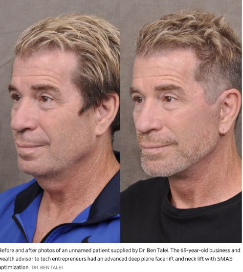 996卷成002后硅谷科技男为不被裁员扎堆做医美……(图6)