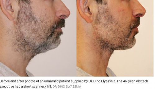 996卷成002后硅谷科技男为不被裁员扎堆做医美……(图5)