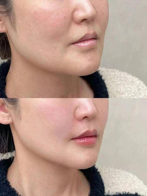 抗皱纹抗衰老的护肤品哪个牌子好？分享真正能淡纹抗皱的护肤品(图5)