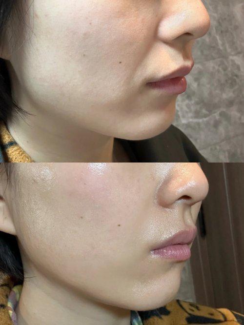 35岁抗衰老提拉紧致护肤品十大排名好用的护肤祛皱品牌种草(图7)