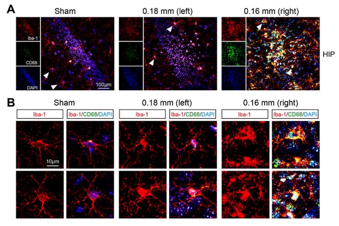 研究进展 红景天苷的健康潜力探讨(图9)