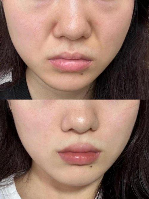 哪个品牌抗皱效果好？45岁护肤品抗衰老解析护肤品抗皱效果汇总(图4)