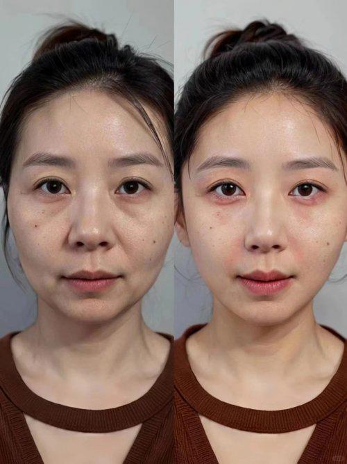 什么化妆品抗皱好？盘点去皱化妆品排行榜前十名抗衰老品牌分享(图5)