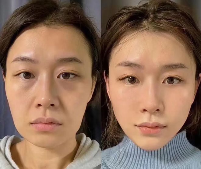 抗衰老产品哪个牌子好？2025抗衰老产品品牌十大排名揭晓榜首靶向清除自由基(图7)