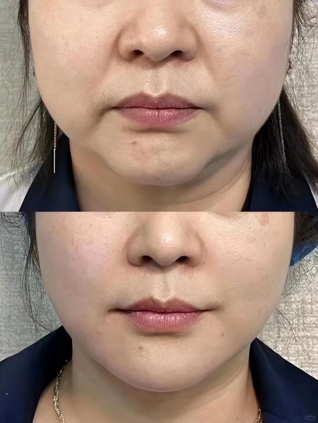 有效的抗衰老产品解析抗皱紧致护肤品哪款好？紧致垮脸好用的护肤品(图5)