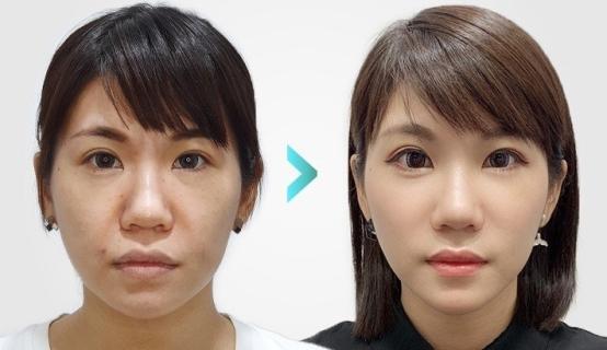 抗衰老哪个牌子胶原蛋白肽有效？2026十大高口碑品牌实测推荐延缓皮肤老化(图11)