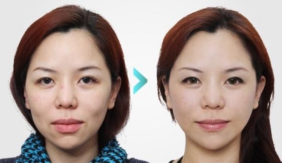 抗衰老哪个牌子胶原蛋白肽有效？2026十大高口碑品牌实测推荐延缓皮肤老化(图12)