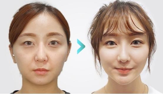 抗衰老哪个牌子胶原蛋白肽有效？2026十大高口碑品牌实测推荐延缓皮肤老化(图13)