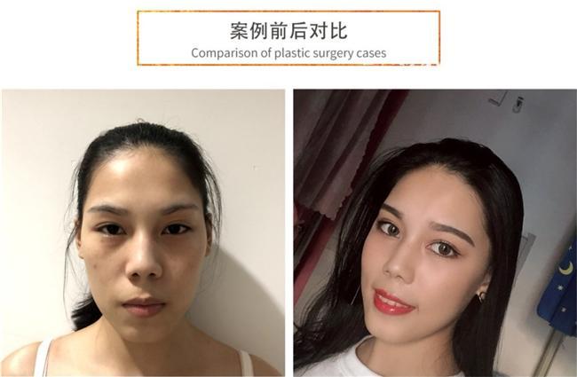 品牌好的胶原蛋白肽哪个效果好？精选2026十款测评推荐抗衰老焕活胶原健康(图13)